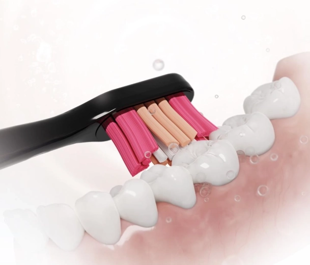 Limpieza minuciosa de los dientes